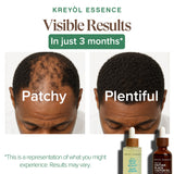 Healthy Hair Revival Bundle