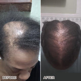 Postpartum Hair Loss Recovery Kit