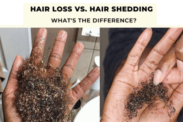 Newsletter: How Much Hair Is Normal To Lose? 🤔