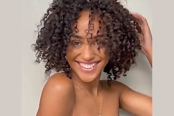 How To Naturally Treat Dandruff and Dry Scalp