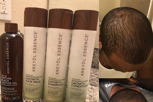 Healthy, Happy, Scalp.... Healthy, Happy, Hair