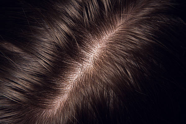 Think You Might Be Losing Hair?