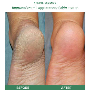 Haitian Black Castor Oil bottles from Kreyòl Essence, part of the Best Seller Haitian Black Castor Oil Growth Trio, displayed together.