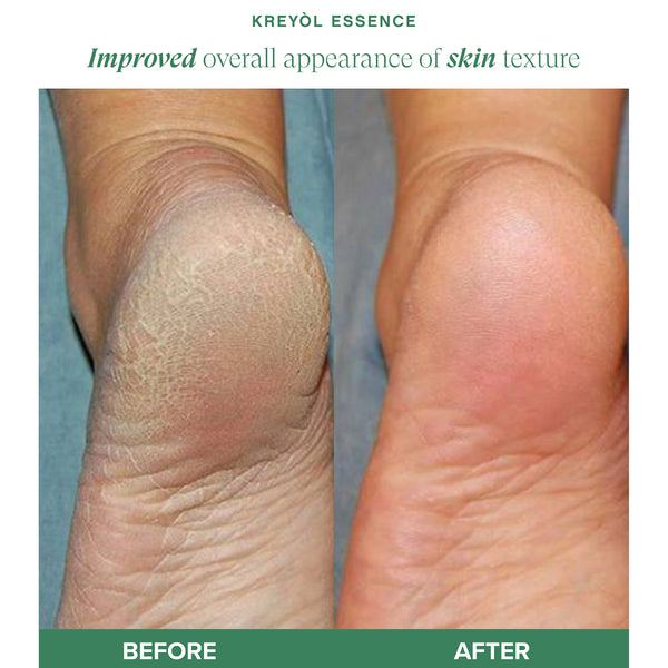 Haitian Black Castor Oil bottles from Kreyòl Essence, part of the Best Seller Haitian Black Castor Oil Growth Trio, displayed together.