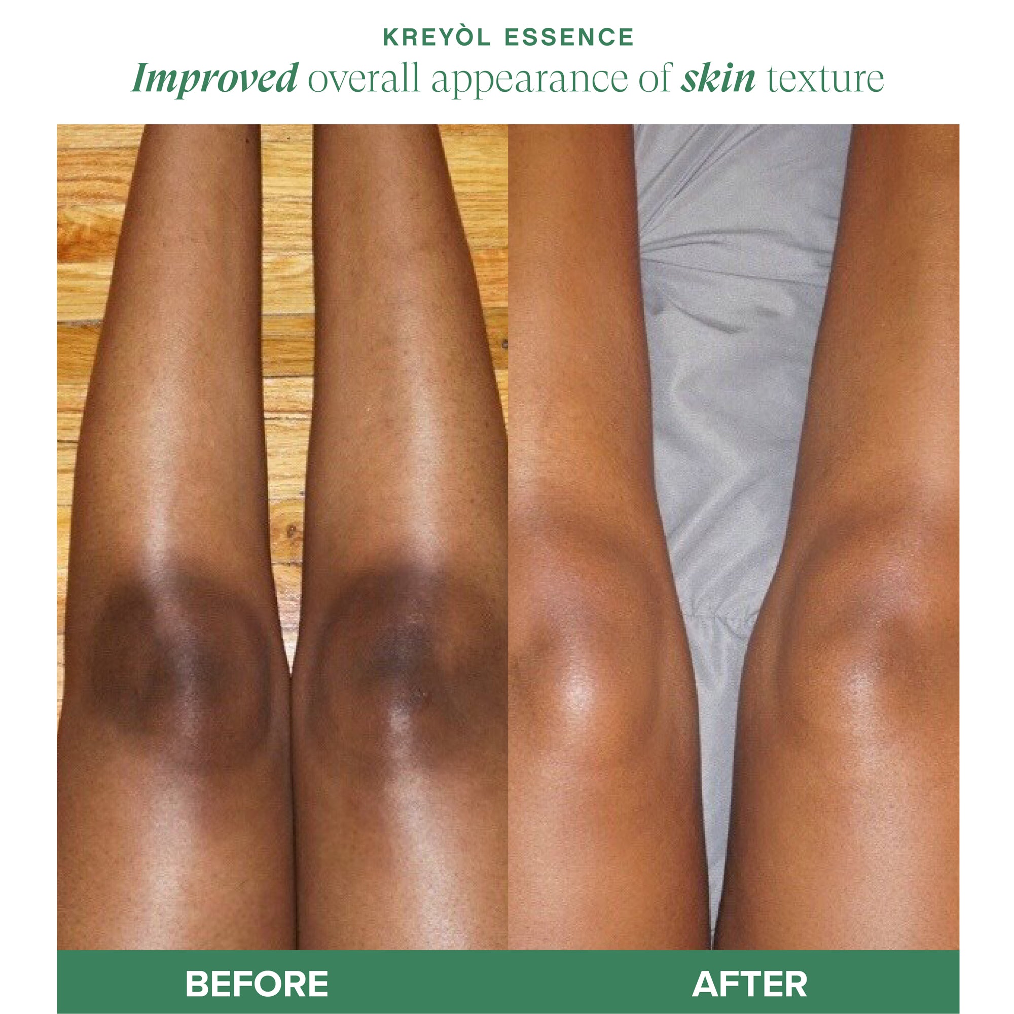 Kreyol Essence Before and After