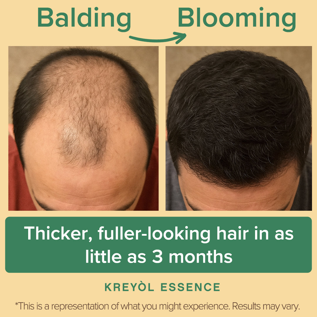 Save My Hair Line - Extra Strength