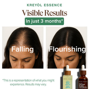 Kreyòl Essence full strength hair treatment bottle for alopecia recovery, with natural ingredients and scalp care benefits.