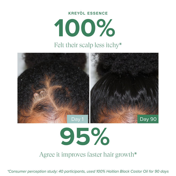 Kreyòl Essence Save My Crown middle part targeted hair serum duo for scalp and hair treatment, with applicator bottles and serum inside