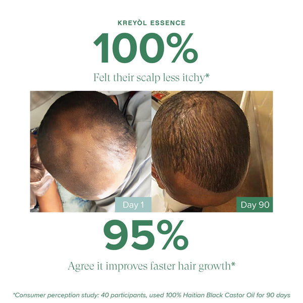 Kreyol Essence Save My Hair Line Extra Strength scalp and hair health treatment in a jar, enhancing hair growth and scalp wellness.