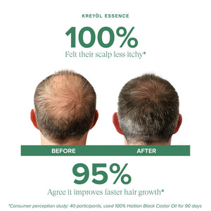 Kreyòl Essence Clinically Proven Scalp and Hair Growth Biotech Shampoo bundle with natural ingredients for healthy hair.