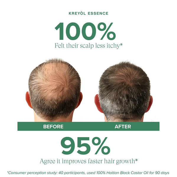 Kreyòl Essence Clinically Proven Scalp and Hair Growth Biotech Shampoo bundle with natural ingredients for healthy hair.