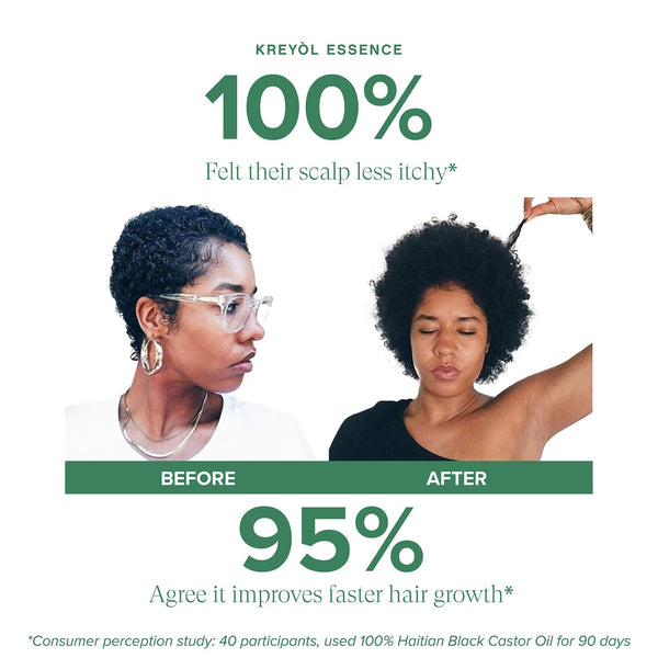 Clinically proven Kreyòl Essence scalp and hair growth shampoo from the biotech bundle, showing the shampoo bottle and natural ingredients.