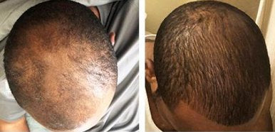 Customer before and after: fuller-looking crown