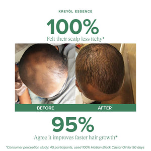 Haitian Black Castor Oil Growth Trio by Kreyòl Essence with three bottles of Haitian Black Castor Oil for hair and skin.