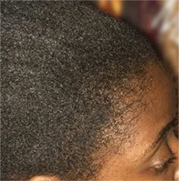 Fuller hair at the crown after using the Kreyol Essence bundle