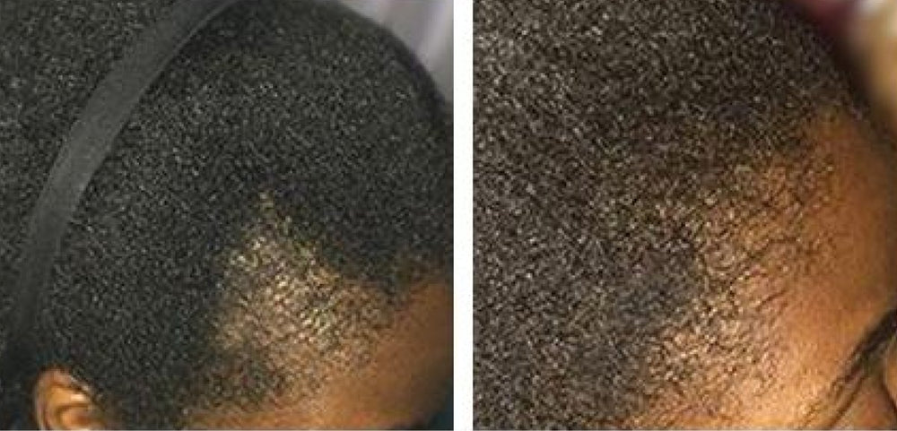 Customer before and after: fuller-looking edges